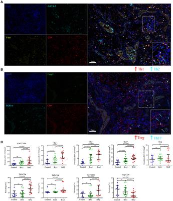 CD4+T Cell Subset Profiling in Biliary Atresia Reveals ICOS− Regulatory T Cells as a Favorable Prognostic Factor